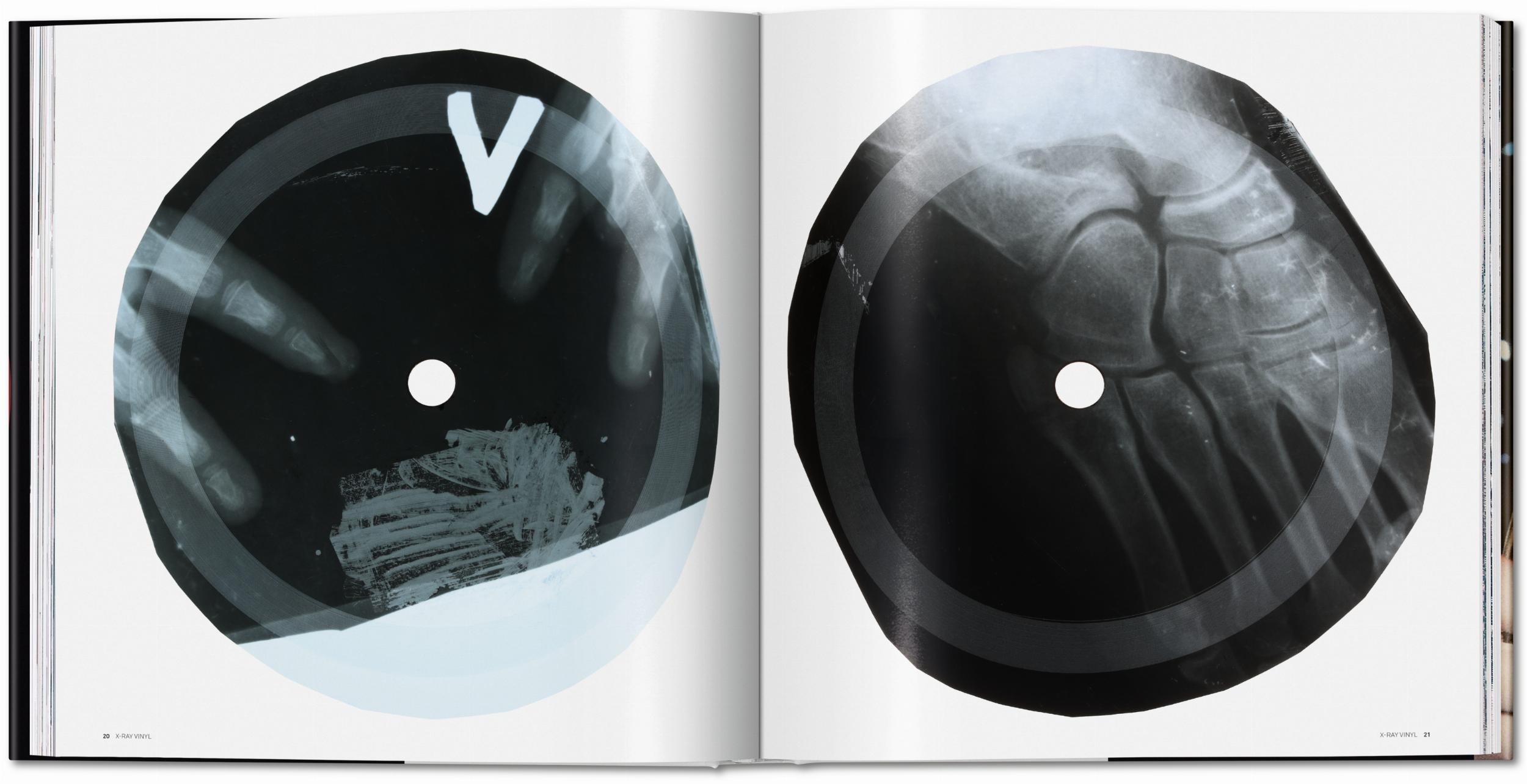 Extraordinary Records - Görsel 4